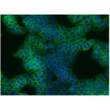 ICC - Anti-beta Catenin Antibody [EM-22] (A86465)
