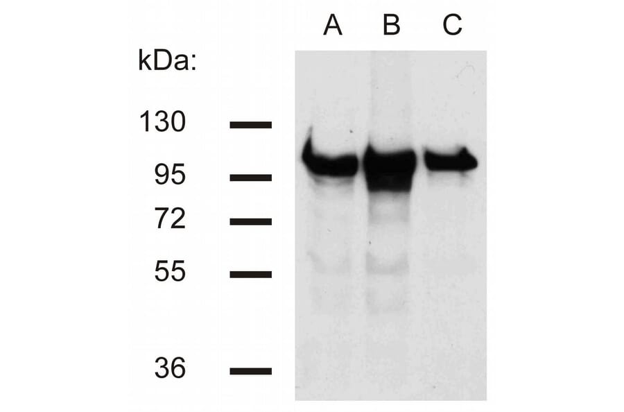 Western Blot - Anti-beta Catenin Antibody [EM-22] (A86465) - Antibodies.com