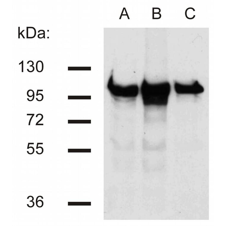 Western Blot - Anti-beta Catenin Antibody [EM-22] (A86465) - Antibodies.com