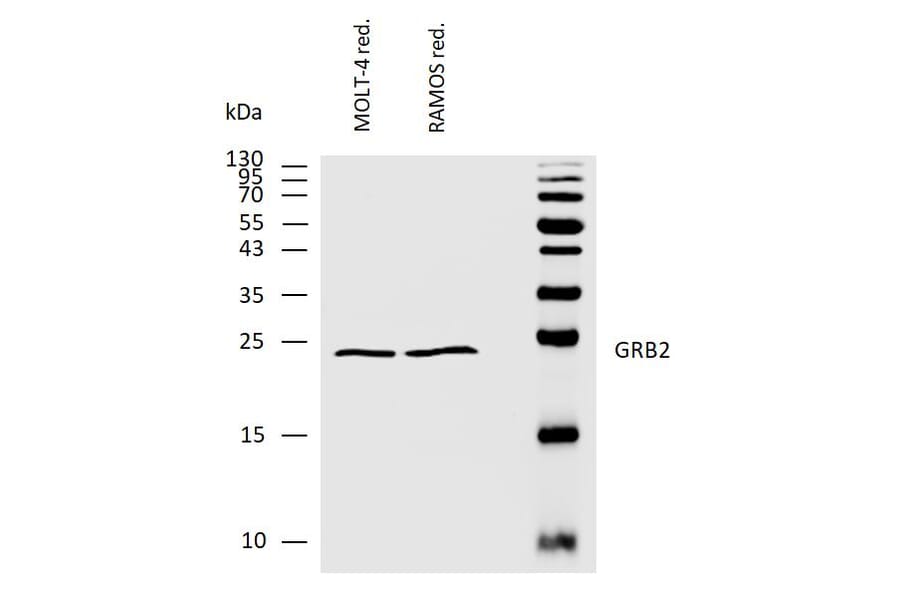 WB - Anti-GRB2 Antibody (A86507)