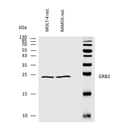 WB - Anti-GRB2 Antibody (A86507)