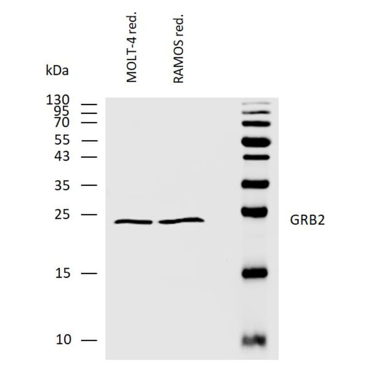 WB - Anti-GRB2 Antibody (A86507)