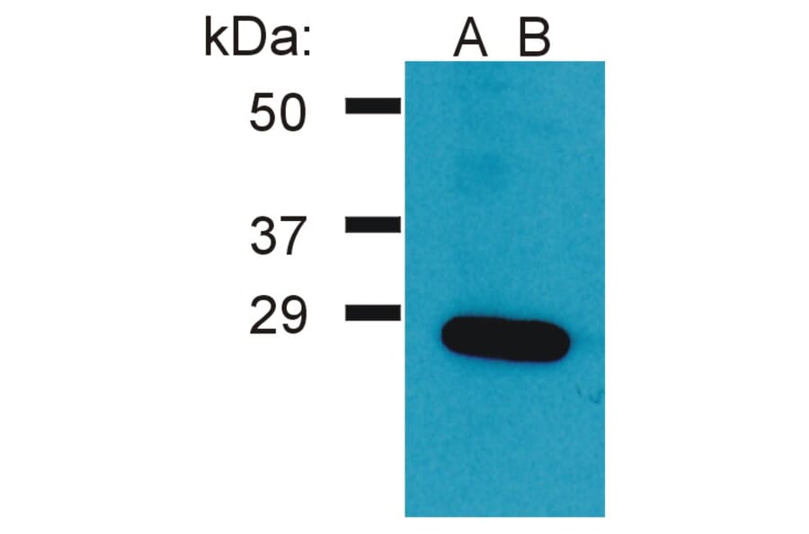 Western Blot - Anti-GRB2 Antibody (A86504) - Antibodies.com