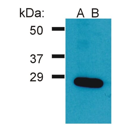 Western Blot - Anti-GRB2 Antibody (A86504) - Antibodies.com