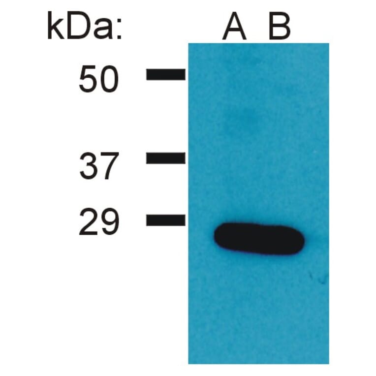 Western Blot - Anti-GRB2 Antibody (A86504) - Antibodies.com