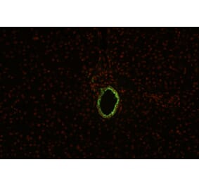 IHC - Anti-Cytokeratin 19 Antibody [BA-17] (A86512)