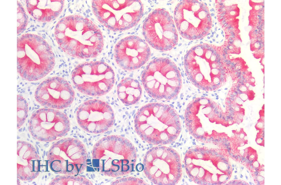 IHC - Anti-Cytokeratin 19 Antibody [BA-17] (A86512)