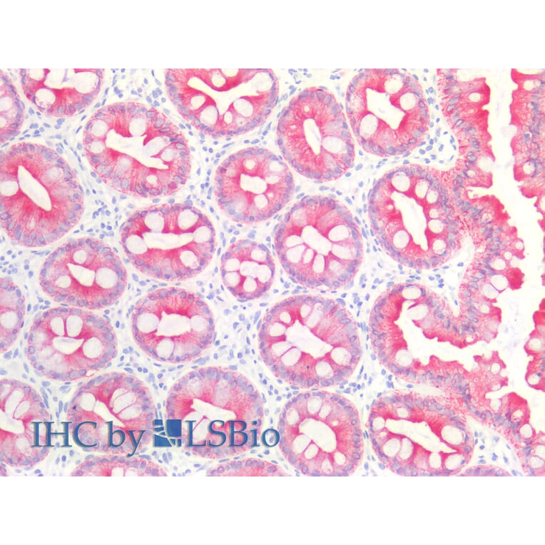 IHC - Anti-Cytokeratin 19 Antibody [BA-17] (A86512)