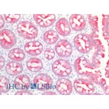 IHC - Anti-Cytokeratin 19 Antibody [BA-17] (A86512)