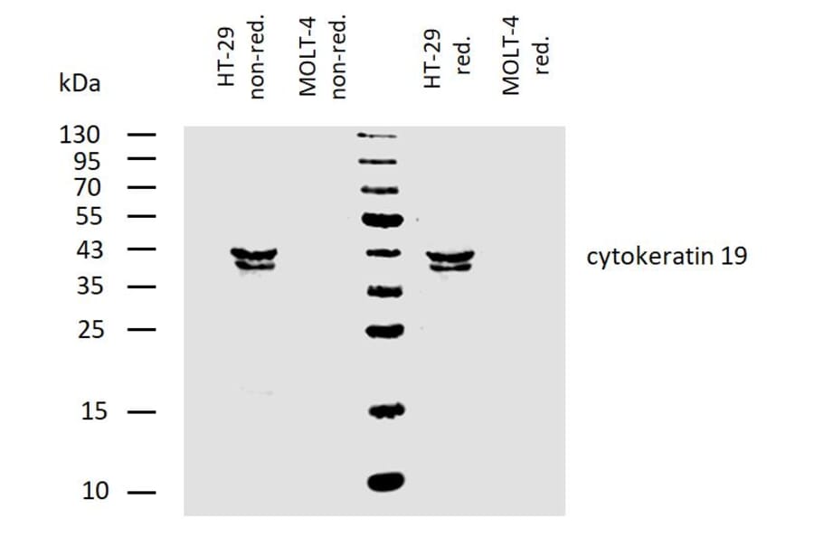 WB - Anti-Cytokeratin 19 Antibody [BA-17] (A86512)