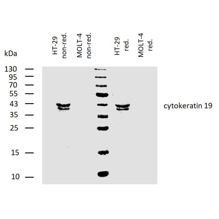 WB - Anti-Cytokeratin 19 Antibody [BA-17] (A86512)