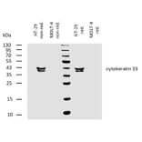 WB - Anti-Cytokeratin 19 Antibody [BA-17] (A86512)