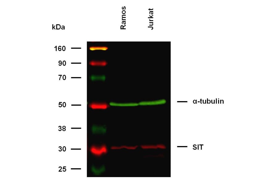 WB - Anti-SIT Antibody [SIT-01] (A86514)