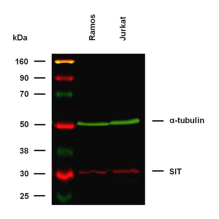WB - Anti-SIT Antibody [SIT-01] (A86514)