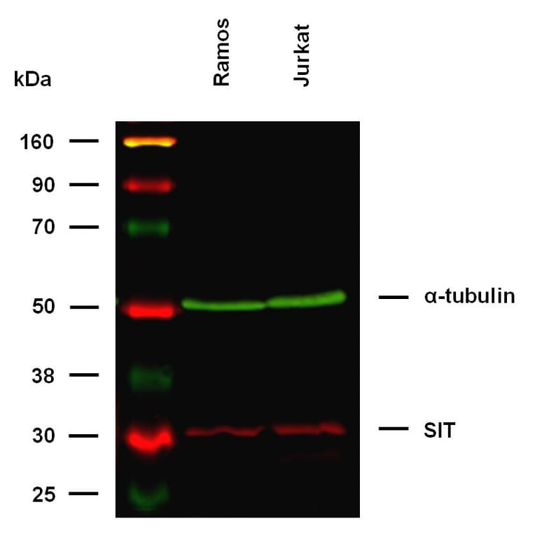 WB - Anti-SIT Antibody [SIT-01] (A86514)