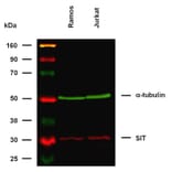 WB - Anti-SIT Antibody [SIT-01] (A86514)
