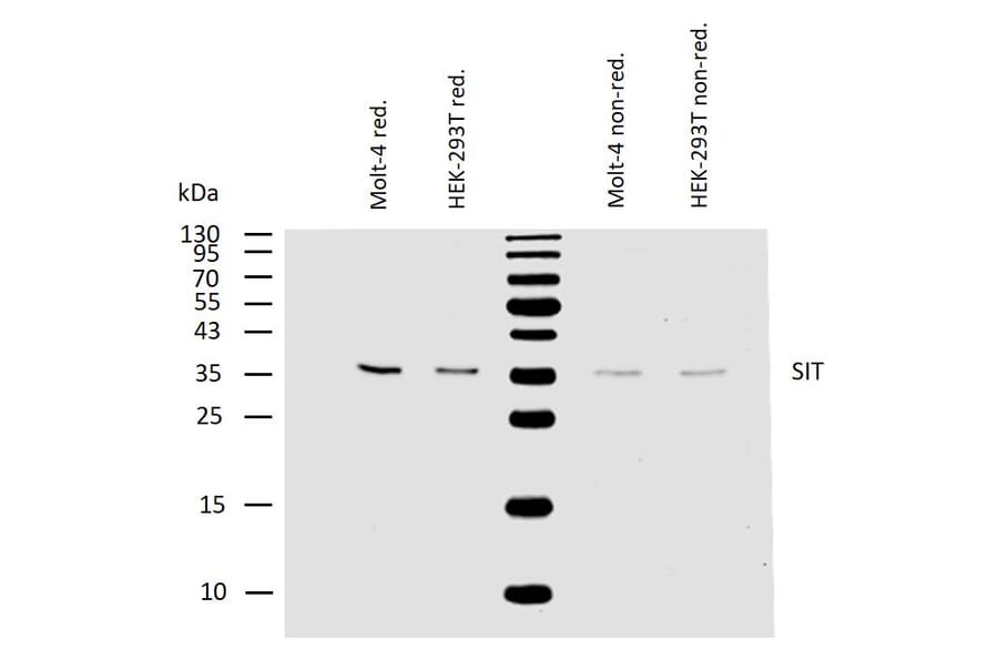 WB - Anti-SIT Antibody [SIT-01] (A86514)