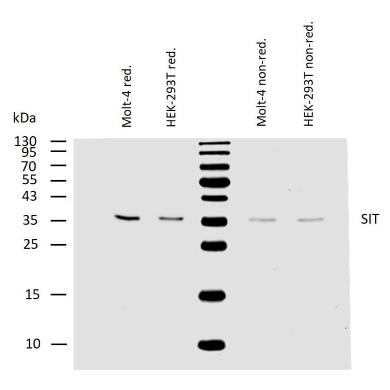 WB - Anti-SIT Antibody [SIT-01] (A86514)