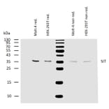 WB - Anti-SIT Antibody [SIT-01] (A86514)