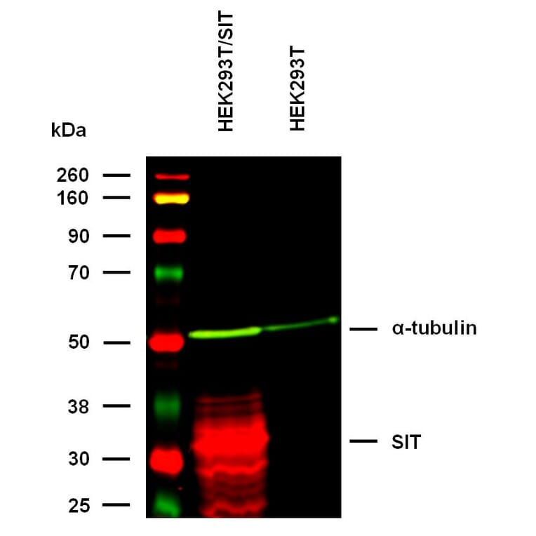 WB - Anti-SIT Antibody [SIT-01] (A86514)