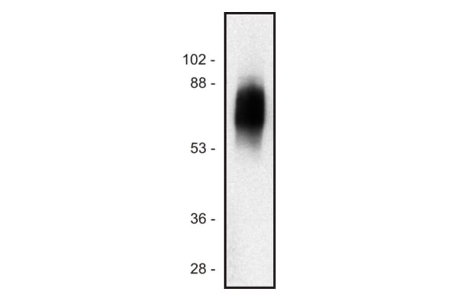 Western Blot - Anti-SIT Antibody [SIT-01] (A86512) - Antibodies.com