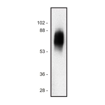 Western Blot - Anti-SIT Antibody [SIT-01] (A86512) - Antibodies.com