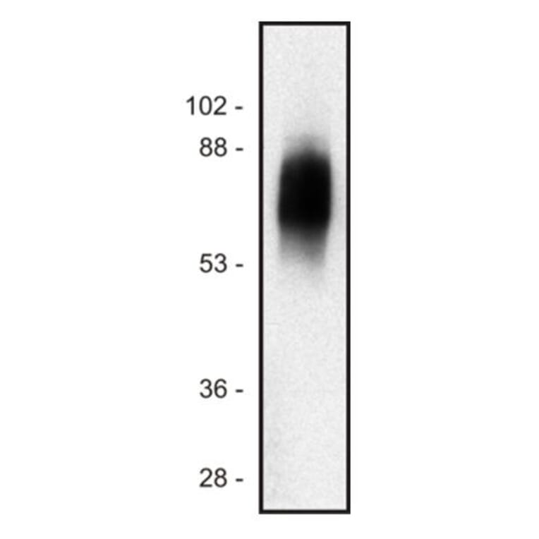 Western Blot - Anti-SIT Antibody [SIT-01] (A86512) - Antibodies.com