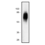 Western Blot - Anti-SIT Antibody [SIT-01] (A86512) - Antibodies.com