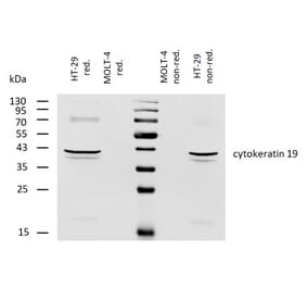 WB - Anti-Cytokeratin 19 Antibody [BA-17] (Biotin) (A86516)