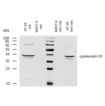 WB - Anti-Cytokeratin 19 Antibody [BA-17] (Biotin) (A86516)