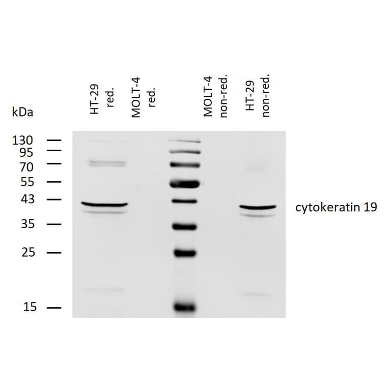 WB - Anti-Cytokeratin 19 Antibody [BA-17] (Biotin) (A86516)