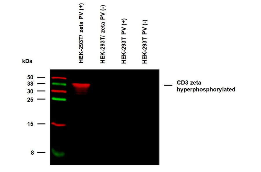 WB - Anti-CD3 zeta (phospho Y153) Antibody [EM-17] (A86524)