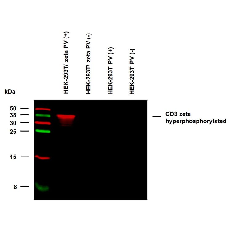 WB - Anti-CD3 zeta (phospho Y153) Antibody [EM-17] (A86524)