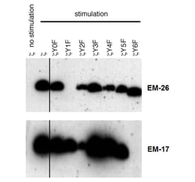 Western Blot - Anti-CD3 zeta (phospho Tyr153) Antibody [EM-17] (A86522) - Antibodies.com