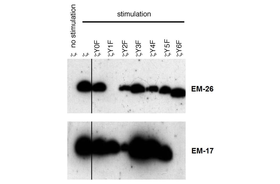 Western Blot - Anti-CD3 zeta (phospho Tyr153) Antibody [EM-17] (A86522) - Antibodies.com