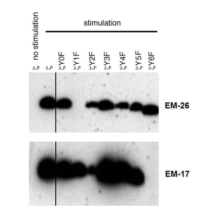 Western Blot - Anti-CD3 zeta (phospho Tyr153) Antibody [EM-17] (A86522) - Antibodies.com