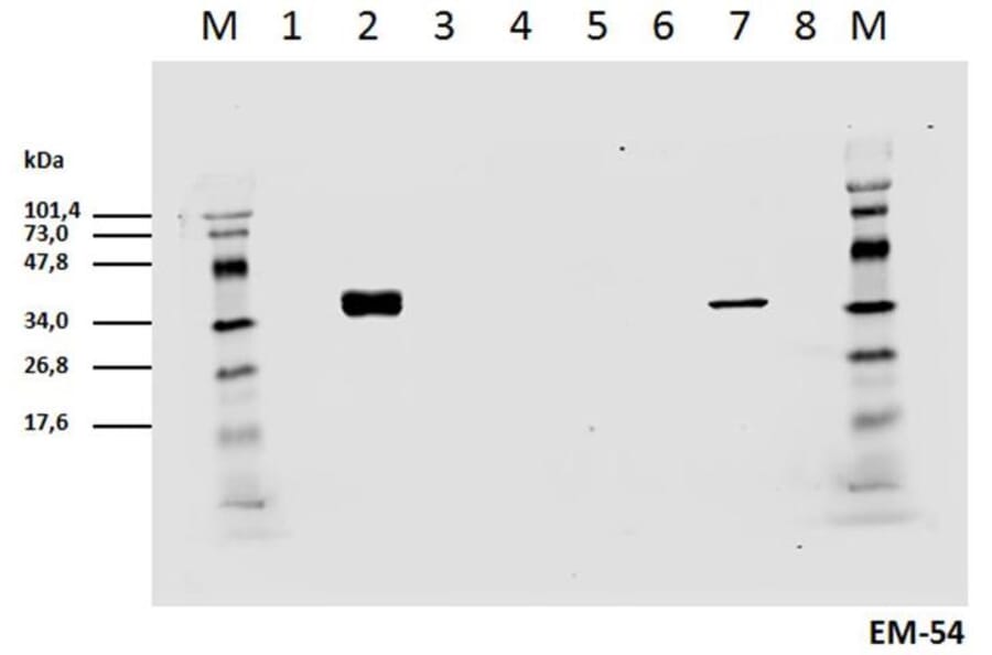 WB - Anti-CD3 zeta (phospho Y142) Antibody [EM-54] (A86525)