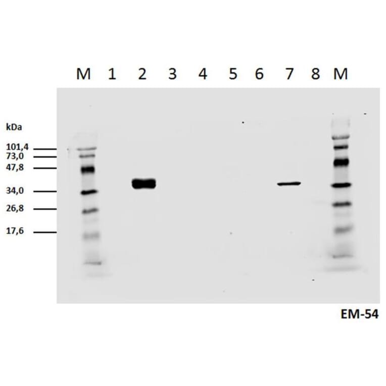 WB - Anti-CD3 zeta (phospho Y142) Antibody [EM-54] (A86525)
