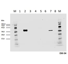 Western Blot - Anti-CD3 zeta (phospho Tyr142) Antibody [EM-54] (A86524) - Antibodies.com