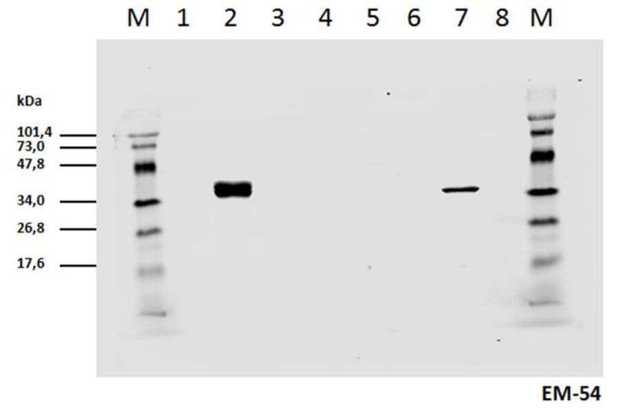 Western Blot - Anti-CD3 zeta (phospho Tyr142) Antibody [EM-54] (A86524) - Antibodies.com