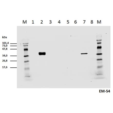 Western Blot - Anti-CD3 zeta (phospho Tyr142) Antibody [EM-54] (A86524) - Antibodies.com