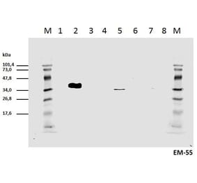 WB - Anti-CD3 zeta (phospho Y111) Antibody [EM-55] (A86526)