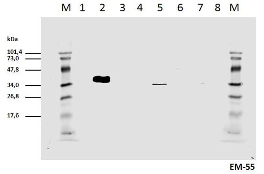 WB - Anti-CD3 zeta (phospho Y111) Antibody [EM-55] (A86526)