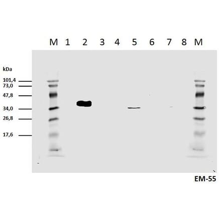 WB - Anti-CD3 zeta (phospho Y111) Antibody [EM-55] (A86526)