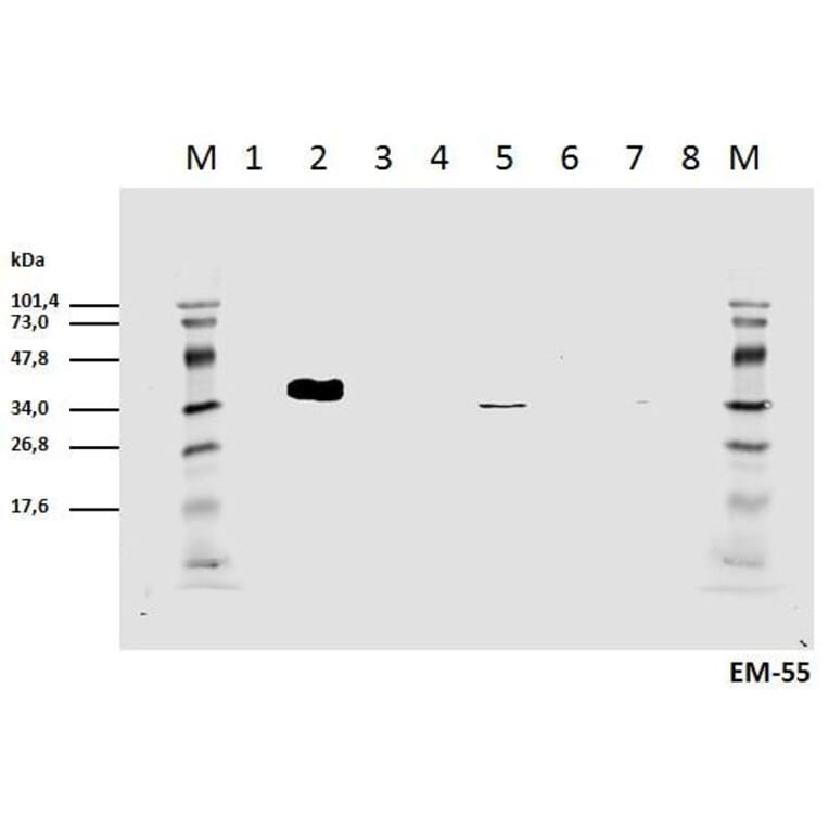 WB - Anti-CD3 zeta (phospho Y111) Antibody [EM-55] (A86526)