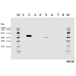 WB - Anti-CD3 zeta (phospho Y111) Antibody [EM-55] (A86526)