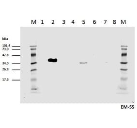 Western Blot - Anti-CD3 zeta (phospho Tyr111) Antibody [EM-55] (A86525) - Antibodies.com
