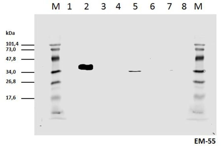 Western Blot - Anti-CD3 zeta (phospho Tyr111) Antibody [EM-55] (A86525) - Antibodies.com
