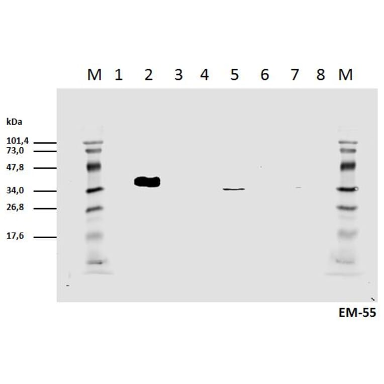 Western Blot - Anti-CD3 zeta (phospho Tyr111) Antibody [EM-55] (A86525) - Antibodies.com