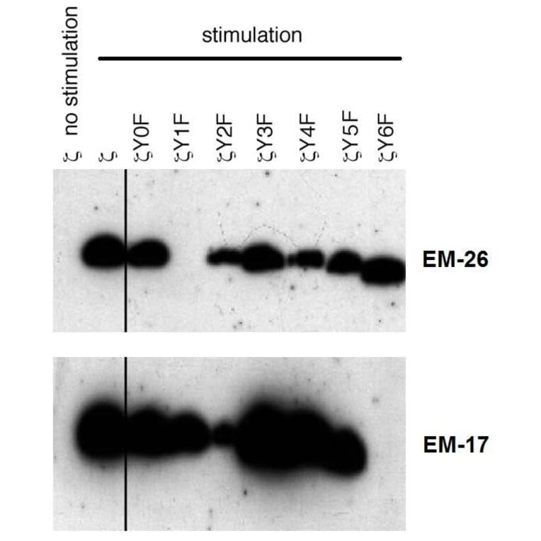 WB - Anti-CD3 zeta (phospho Y72) Antibody [EM-26] (A86536)